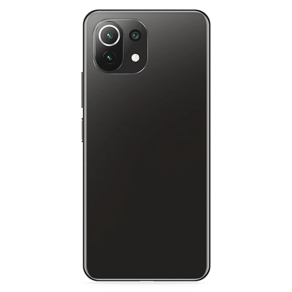 Xiaomi 11 Personalised Phone Cases & Covers preview